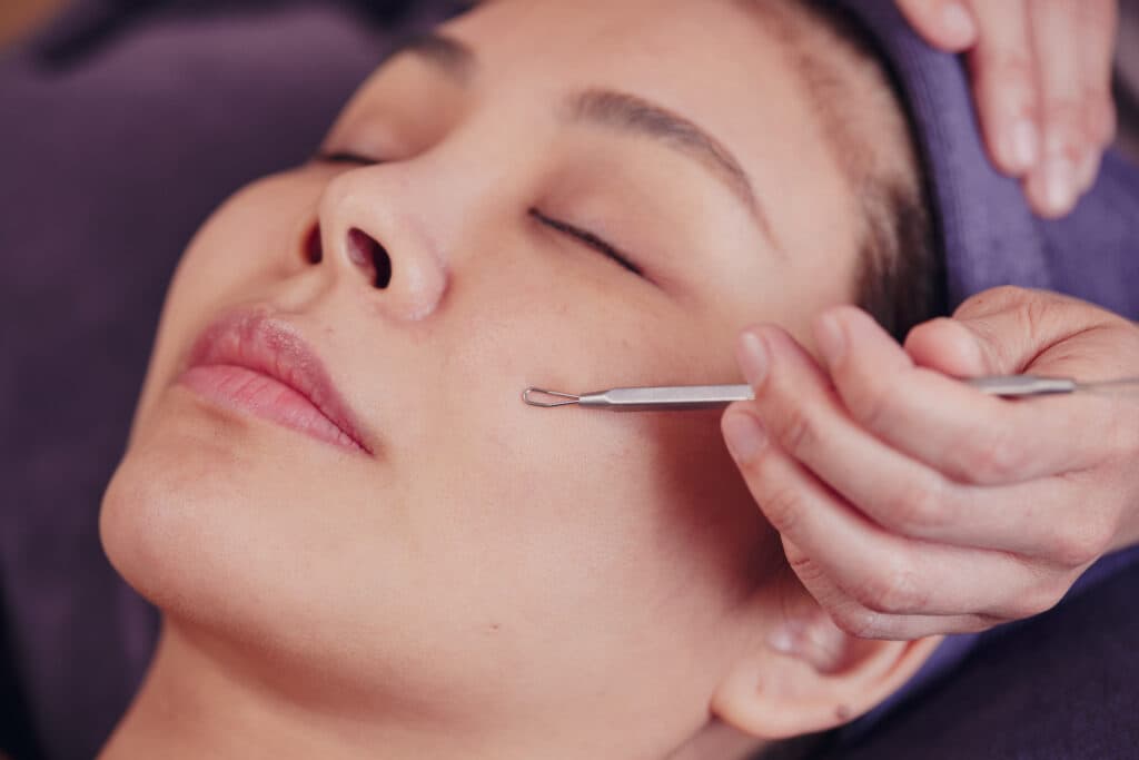 Black head facial at Meow Aesthetics
